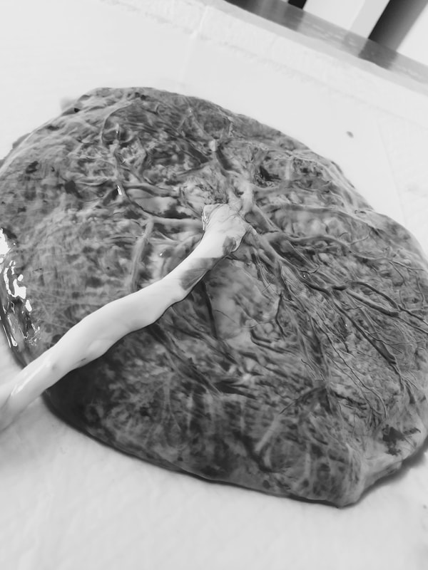 Black and white image of a human placenta showing the vasculature and umbilical cord connected to the fetal side of the placenta.  Image taken by Adelaide's placenta encpasulation specialist, Kelly @ Elemental Beginnings