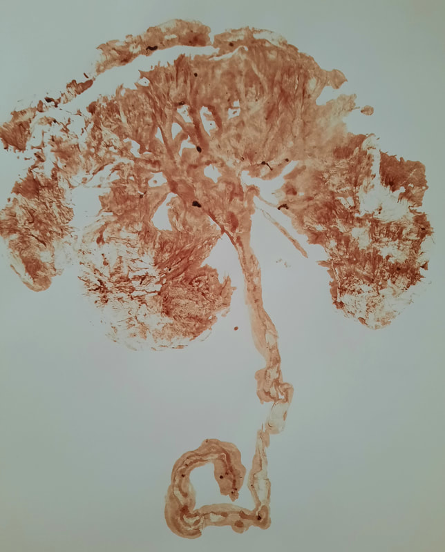 The tree of life.  A print of your placenta done using the natural blood contained on the surface.  Your placenta looks like a tree with a strong trunk and many branches growing to support your baby.  Copyright Elemental Beginnings